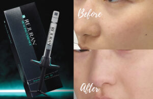 美肌再生の新常識!話題の「リジュラン」とは?